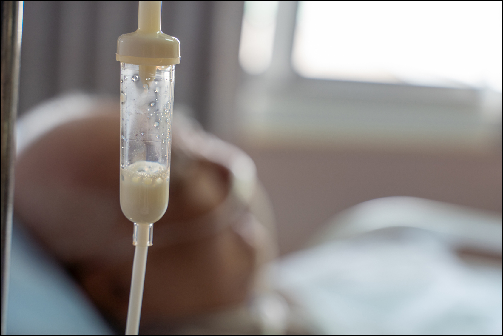 CLoseup of feeding tube holding liquid nutrition for hospital patient